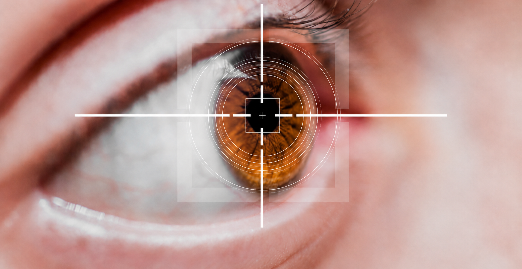 LASIK, ReLEx SMILE, SMILE PRO, atau SiLK? Memahami Perbedaannya Sebelum Memilih