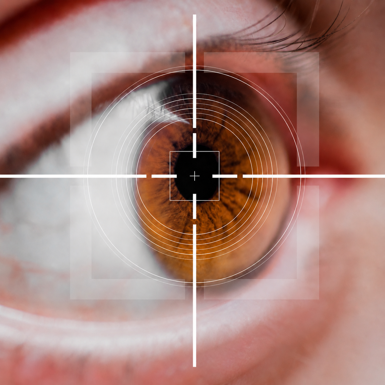 LASIK, ReLEx SMILE, SMILE PRO, atau SiLK? Memahami Perbedaannya Sebelum Memilih